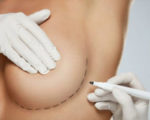 What Happens after a Breast Augmentation?