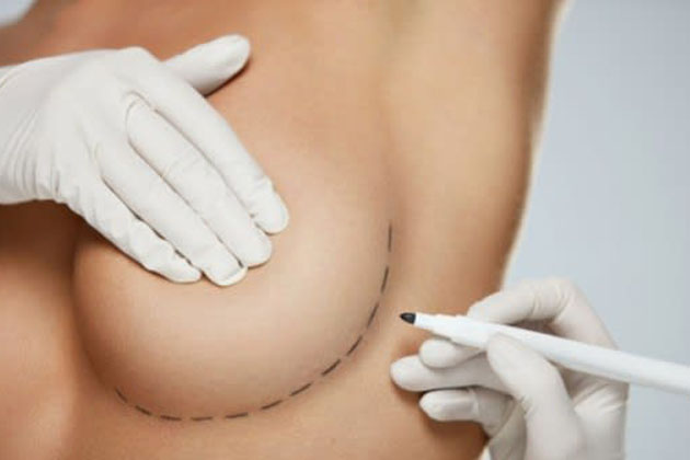 What Happens after a Breast Augmentation?
