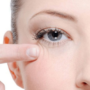 Blepharoplasty-philippines