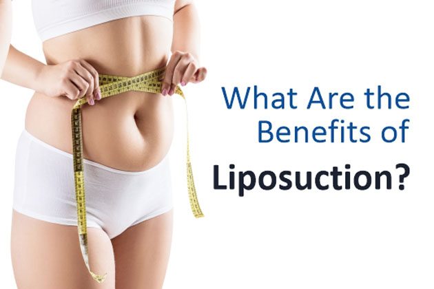 what are the benefits of liposuction
