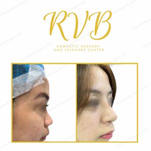 Before and After Photos in Cosmetic Surgery