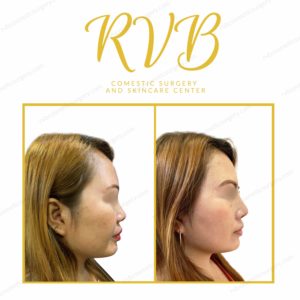 Before and After Photos in Cosmetic Surgery