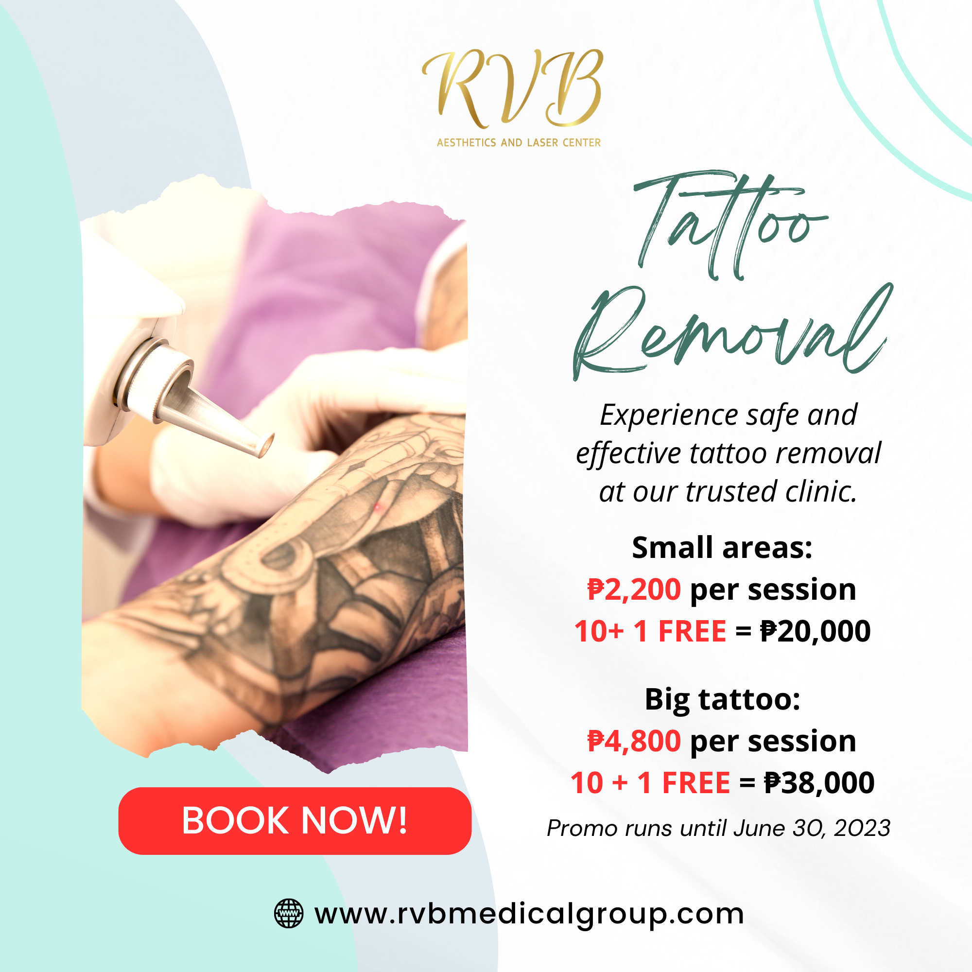 tattoo-removal