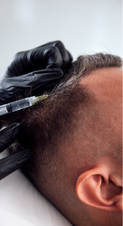Hair Restoration RVB