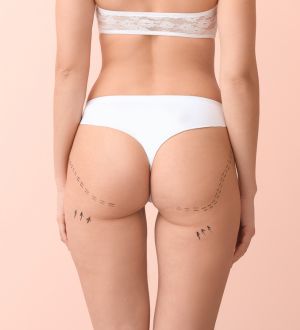 RVB Buttocks Enhancement